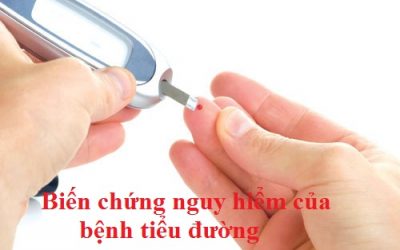 thao-duoc-teresa-herbs-bien-chung-benh-tieu-duong-va-cach-phong-tranh