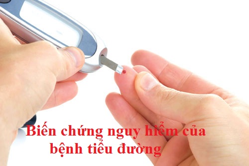 Biến chứng bệnh tiểu đường và cách phòng tránh