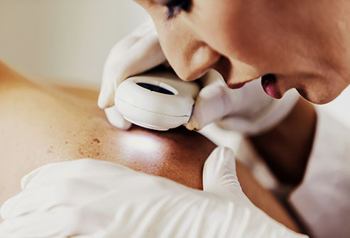 15 Dấu hiệu cho thấy bạn có thể bị Ung thư