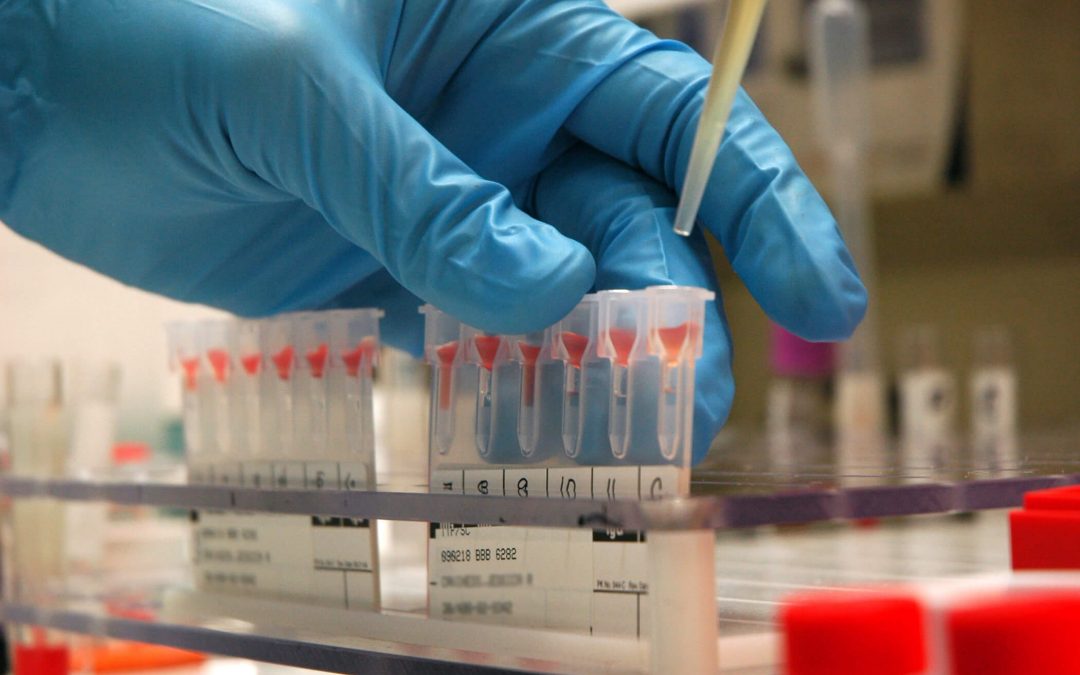 Xét nghiệm HbA1C trong điều trị tiểu đường