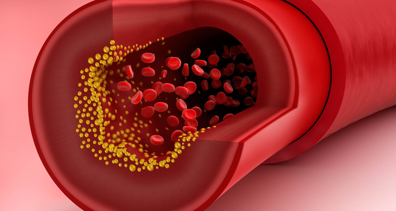 Dây thìa canh có thể giúp hạ thấp mức cholesterol LDL và chất béo trung tính