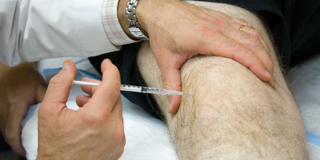 Viêm khớp vảy nến tiêm thuốc vào các khớp