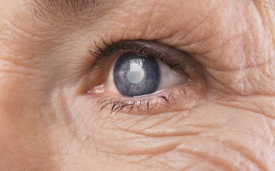 (Tiếng Việt) Biến chứng mắt ở người bệnh tiểu đường – Những điều cần biết để phòng tránh