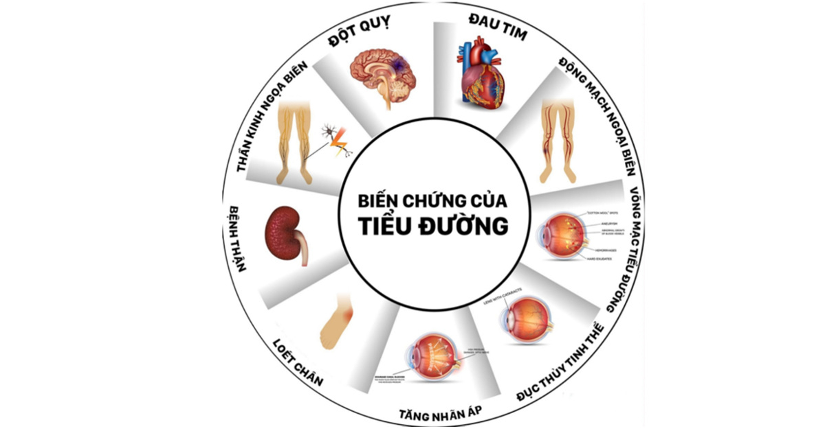 bien-chung-tieu-duong-bac-si-luong-le-hoang