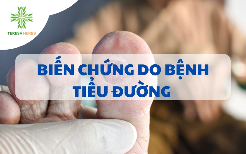 BIẾN CHỨNG DO BỆNH TIỂU ĐƯỜNG GỒM NHỮNG GÌ?
