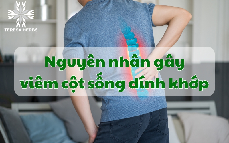 (Tiếng Việt) Nguyên nhân gây viêm cột sống dính khớp?