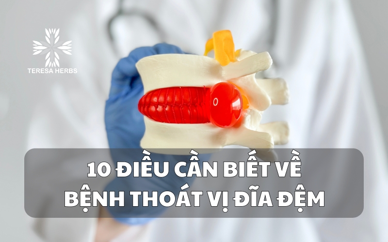 (Tiếng Việt) 10 Điều cần biết về bệnh thoát vị đĩa đệm: Nguyên nhân, triệu chứng và điều trị