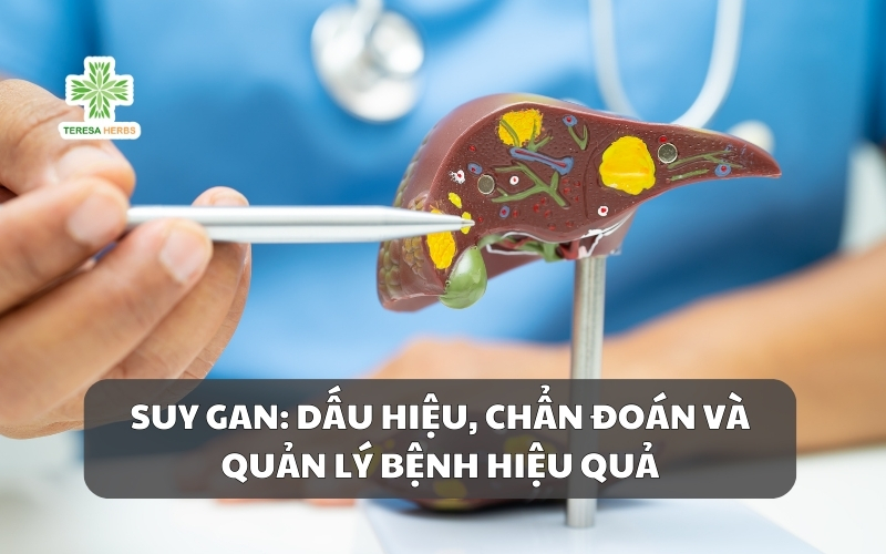(Tiếng Việt) Suy Gan: 5 Dấu Hiệu, Chẩn Đoán Và Quản Lý Bệnh Hiệu Quả